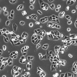Cells under a microscope